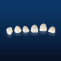 Advanced na Dental IPS Emax para sa Pagpapanumbalik
